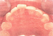 Figure 3. Occlusal View